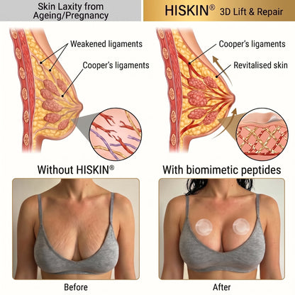 👩‍⚕️ Breast Firming & Fuller-Looking Curves HISKIN® — Advanced Nano-Microneedle Patch for Targeted Care -1