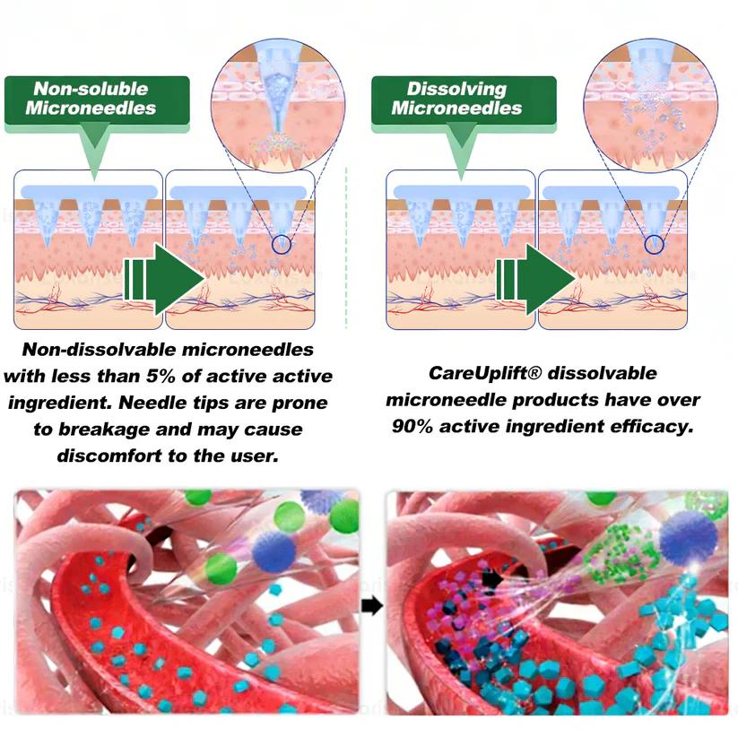 ❤️Official Store | 🍋 Solaroza® Moringa & Berberine 15-IN-1 Advanced Nano Microneedle Patch (Once Daily, visible changes in 7 days) ✅ Obesity, Diabetes, Sleep Apnea, And Joint Issues (副本)