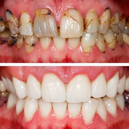 🧑‍⚕️🦷❄️Solaroza® Gum Revive periodontal repair gel