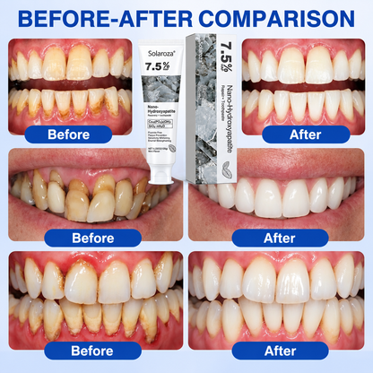 🧑‍⚕️🦷❄️Solaroza® Gum Revive periodontal repair gel